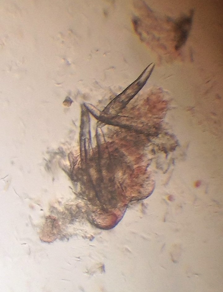 Microscope image of skin