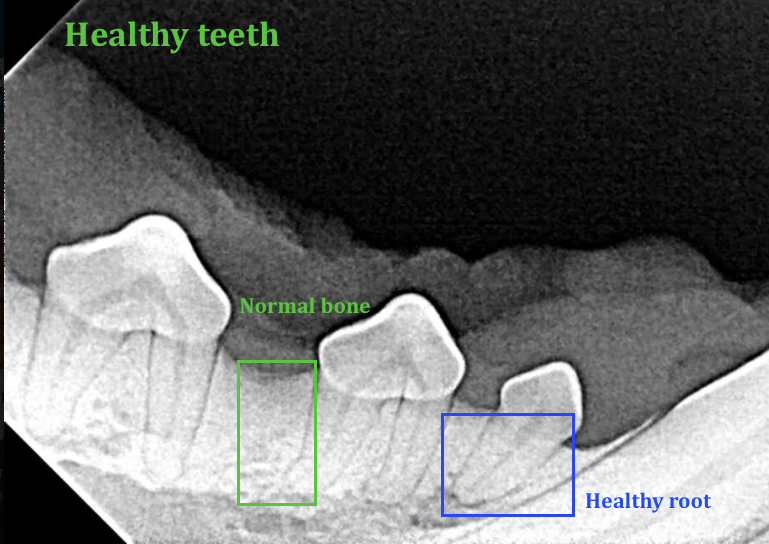 Photo of x-ray showing health teeth in dog 